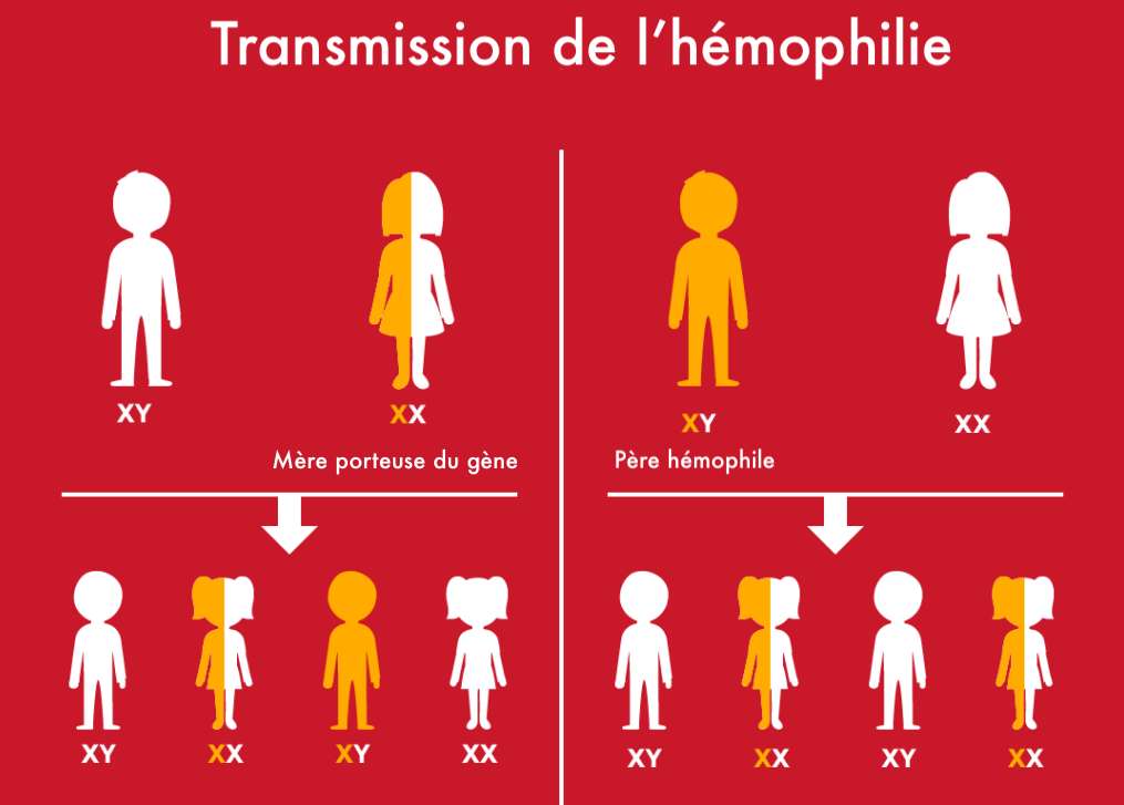 Transmission récessive liée au sexe (chromosome X) de l'hémophilie